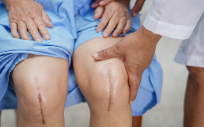 Meet Dr. Turner Brown: Orthopedic Surgeon Specializing in Hip & Knee Reconstruction